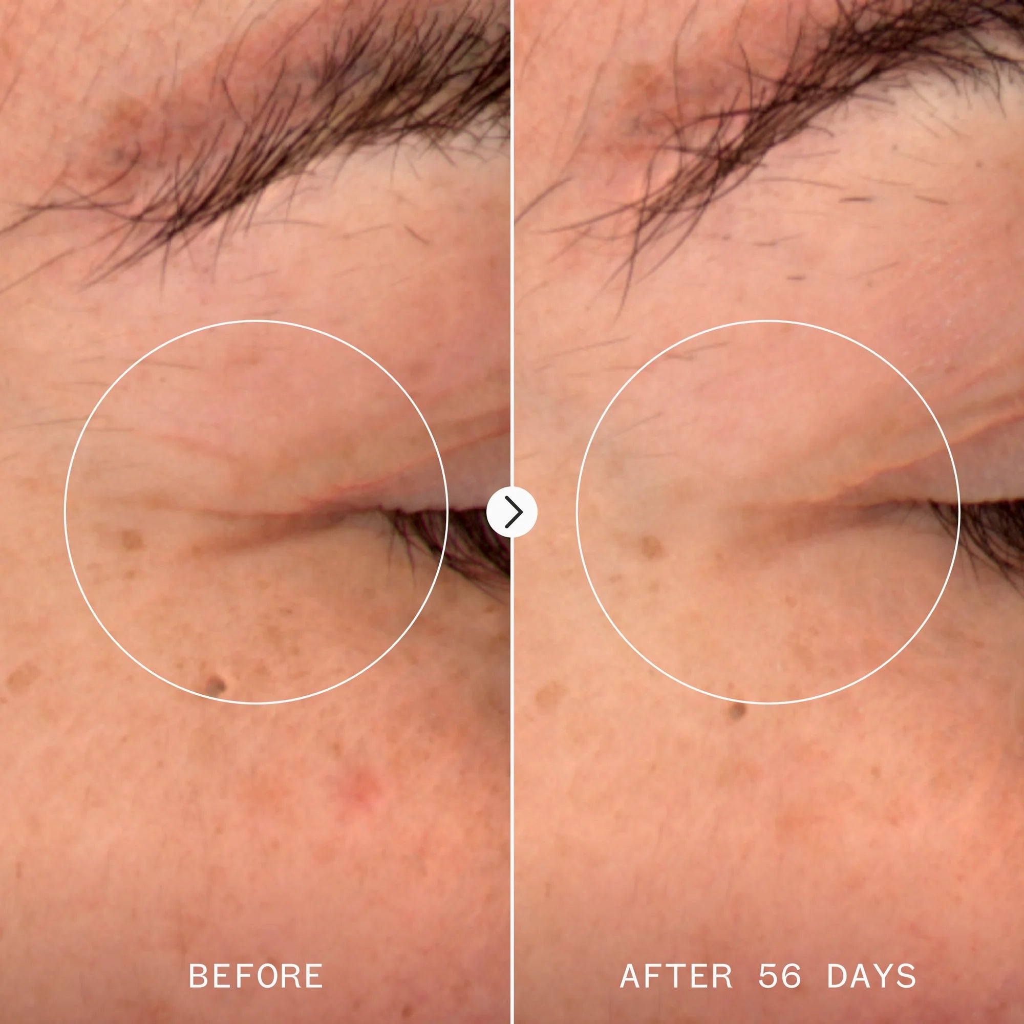 Pai Skincare Age Confidence™ NAD+ & TriPeptide Renewal Serum