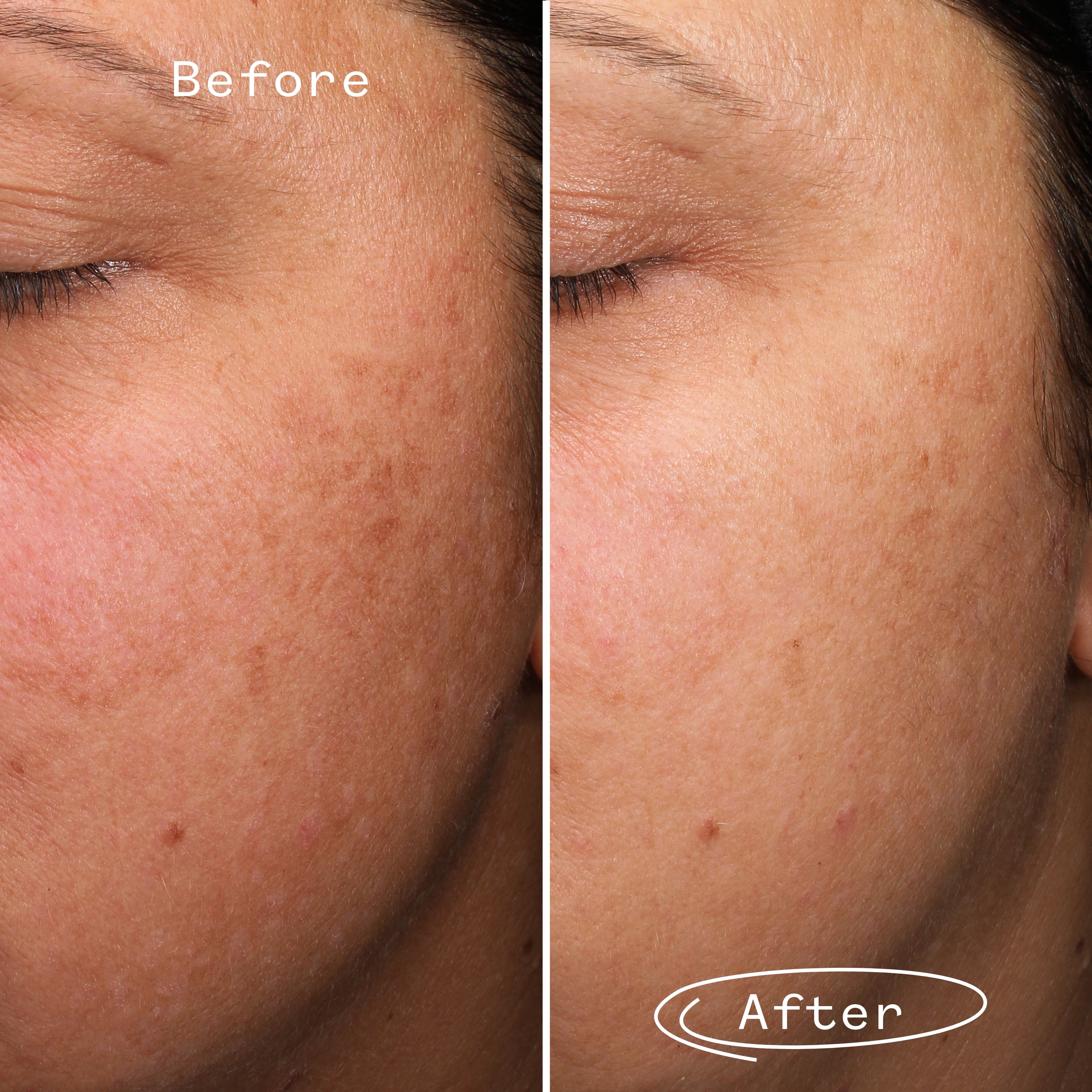 Pai Skincare Fade Forward™ Dark Spot Serum For Sensitive Skin