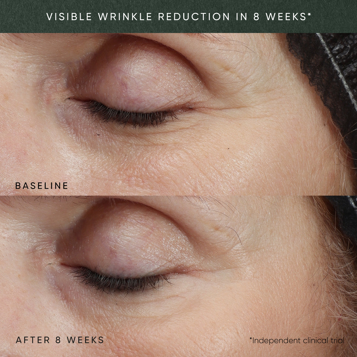 Irene Forte Phytomelatonin Rejuvenating Eye Cream With Dr. Ferri APM™ & Phyto-Exosomes