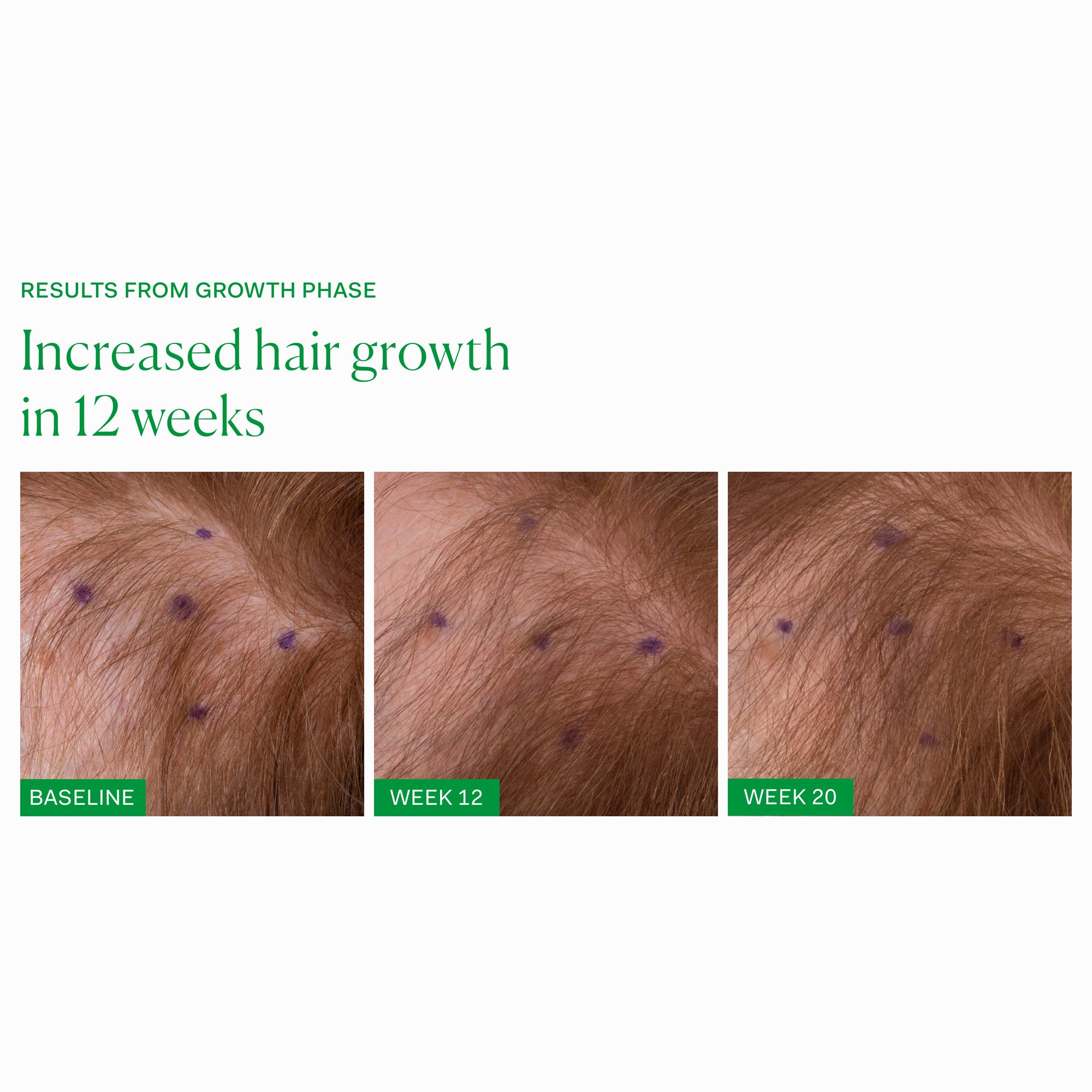 The Nue Co. Growth Phase Supplement