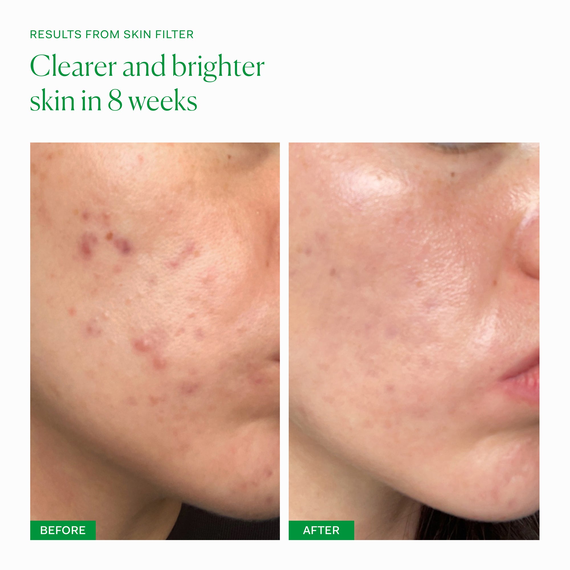 The Nue Co. Skin Filter Supplement