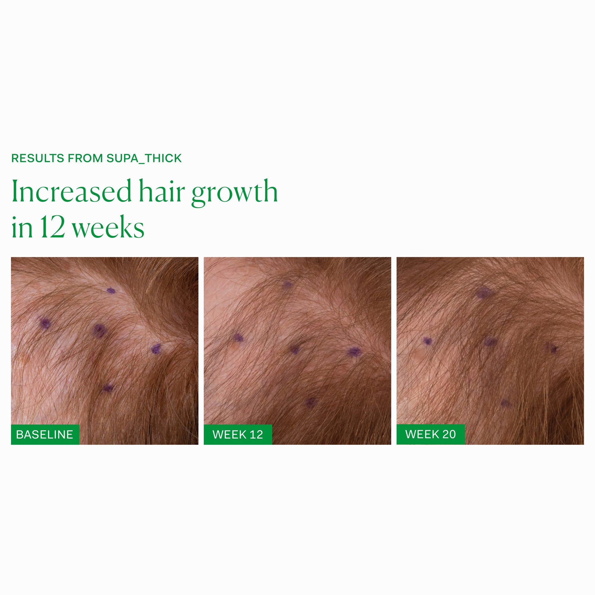 The Nue Co. Supa Thick Topical Scalp Serum