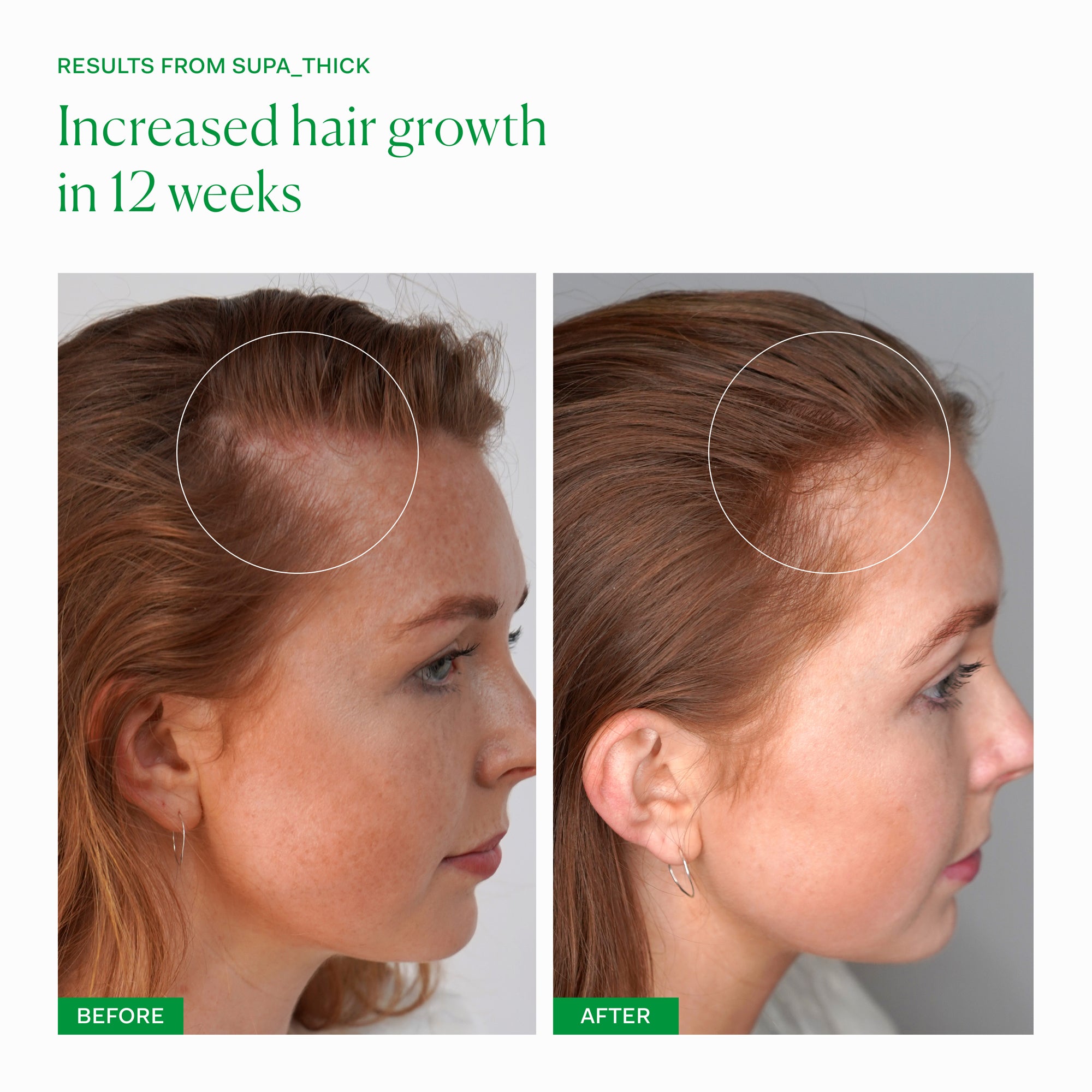 The Nue Co. Supa Thick Topical Scalp Serum